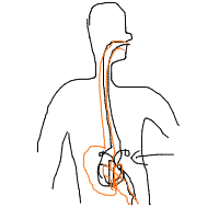 butterflies in stomach drawing by laudasur in Artbitrator
