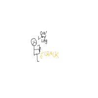 break a leg drawing by bigboy2000infinitemoneyultimateglitchupdated2007 in Artbitrator