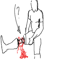 break a leg drawing by gerrard_filbert in Artbitrator