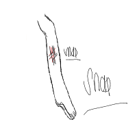 break a leg drawing by andi00 in Artbitrator