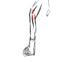 break a leg drawing by anonymoosse679 in Artbitrator