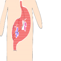 butterflies in stomach drawing by lucy in Artbitrator